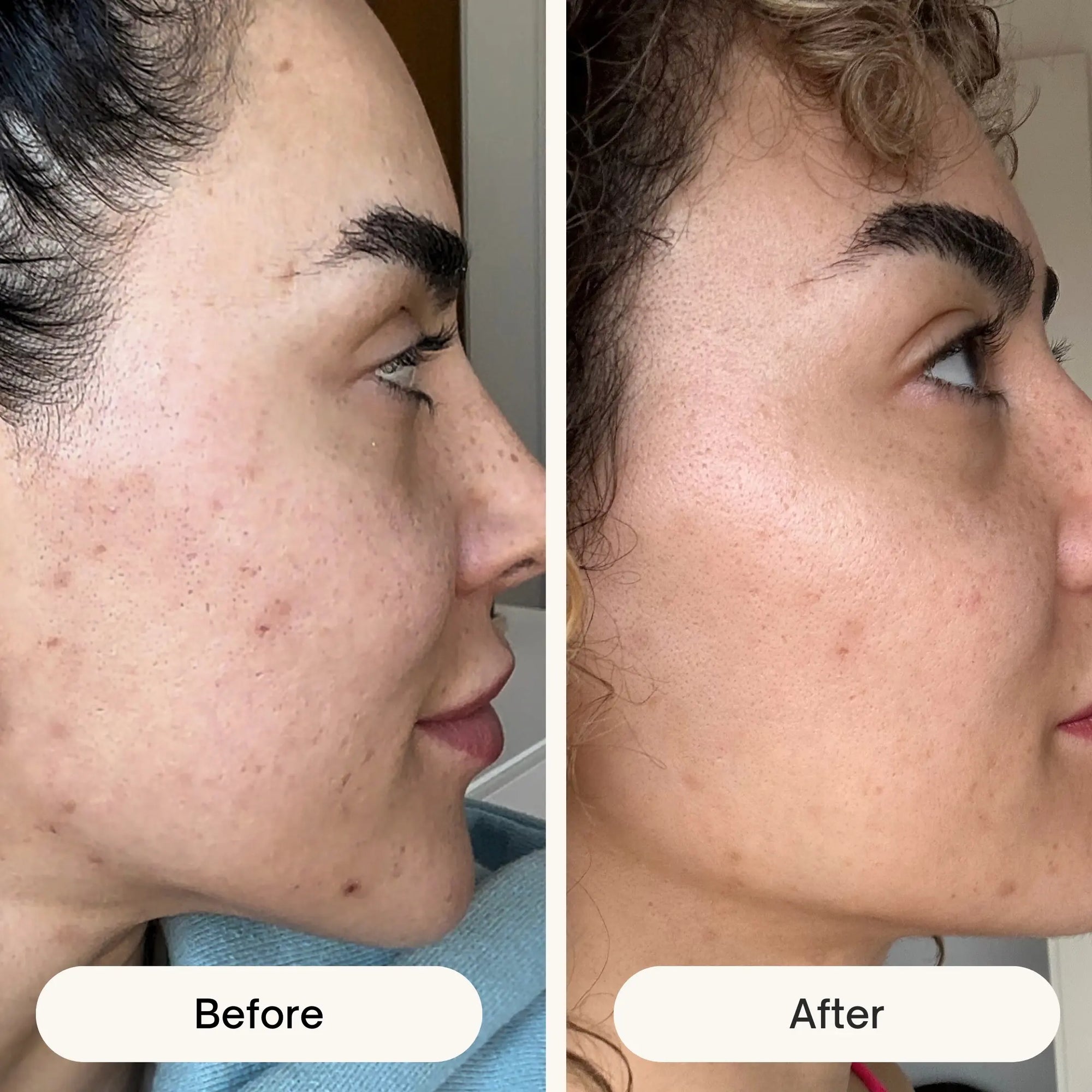 Can You Use Exfoliating Gloves on Your Face?